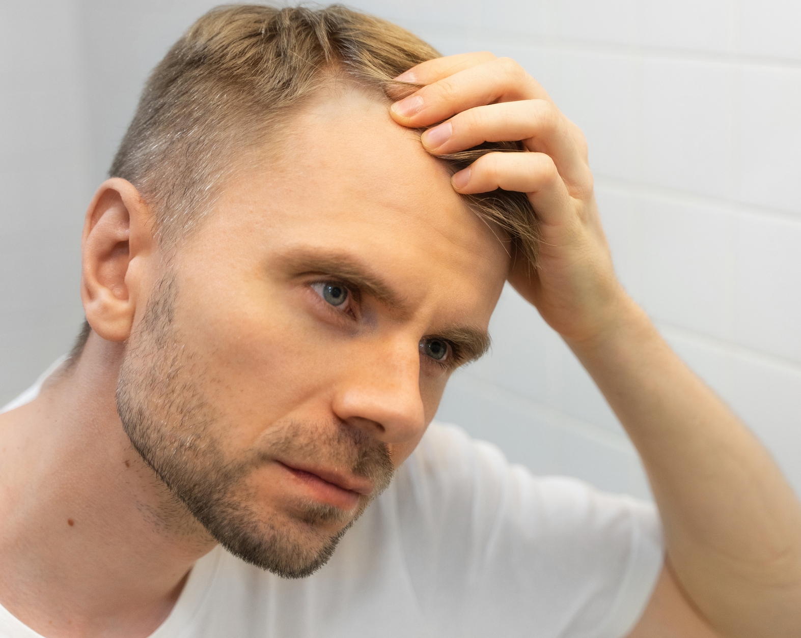 Мужчина с алопецией