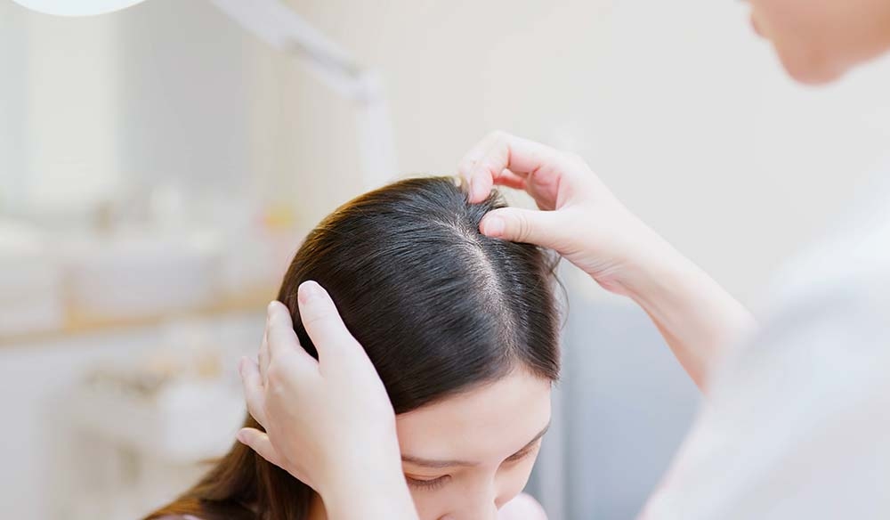 Жирная кожа головы