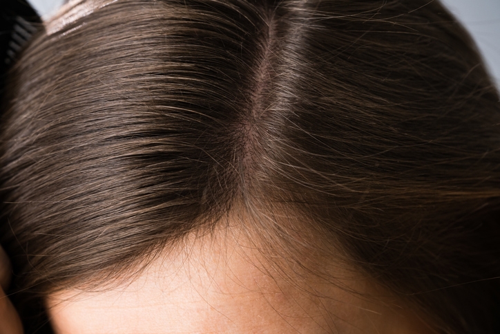 Прикорневая зона волос, пробор