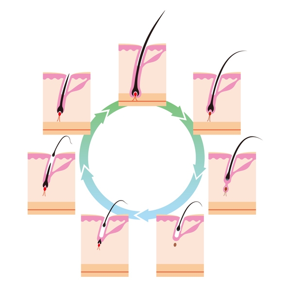 Схема цикла роста волос: анаген, катаген, телоген, экзоген