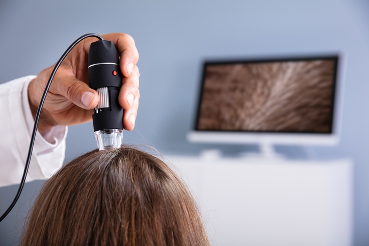 Врач проводит диагностику кожи головы пациента трихоскопом