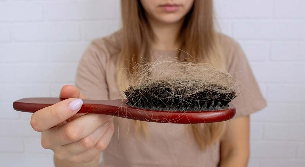 Выпадение волос после стресса