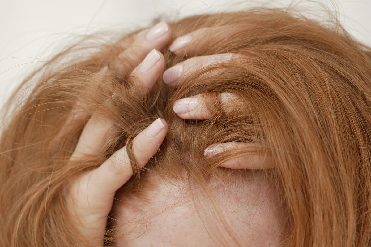 Сухая кожа головы больше склонна к зуду